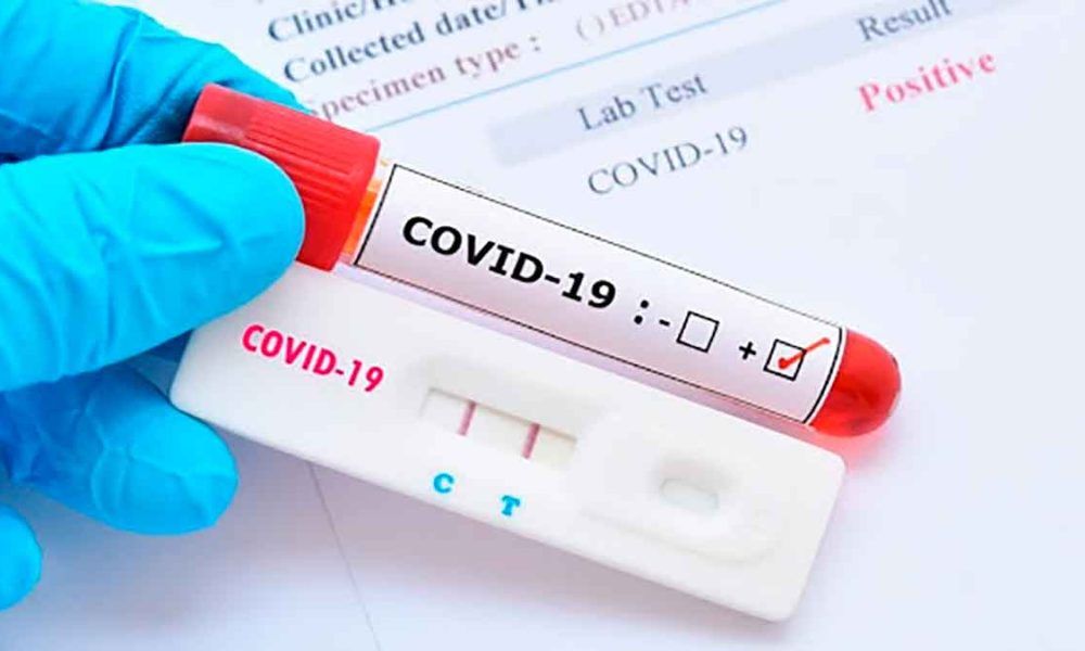 Alcaldía realizará pruebas gratuitas de coronavirus en zonas prioritarias de Villavicencio