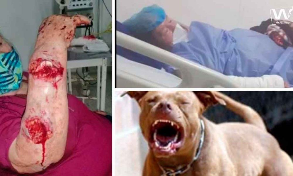 En Villavicencio, una mujer de 79 años sufrió el ataque de un perro pitbull
