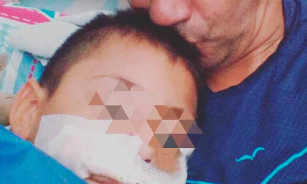 A cirugía reconstructiva niño que fue atacado por un perro en Villavicencio
