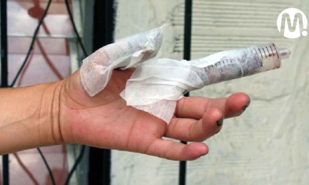 Primer quemado con pólvora en el Meta es un menor de edad