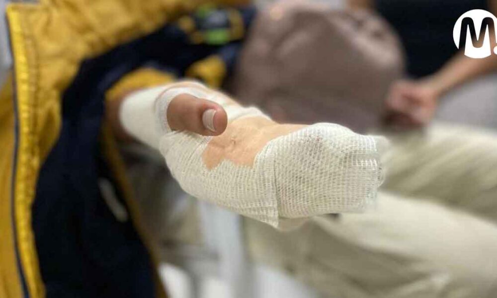 Reportan primer quemado con pólvora en Villavicencio