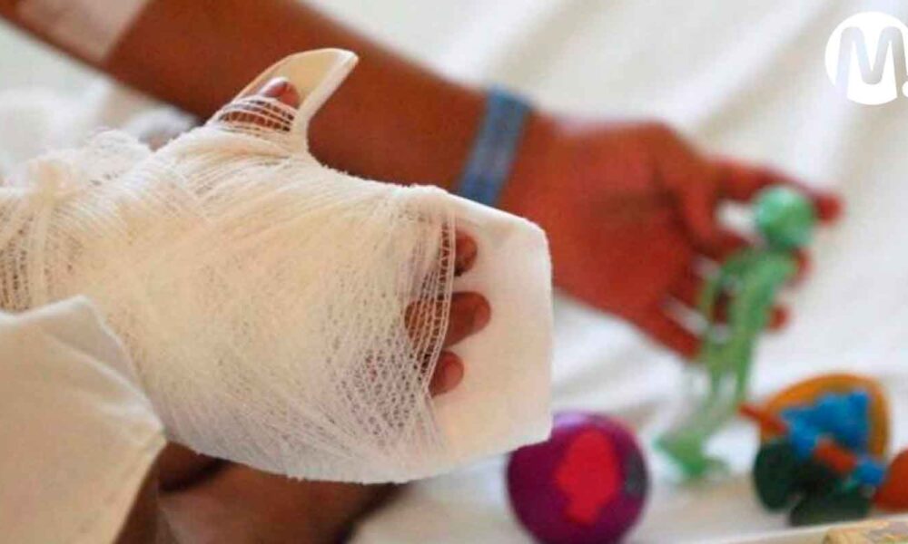 Por reto de TikTok, menor sufrió graves quemaduras en Villavicencio