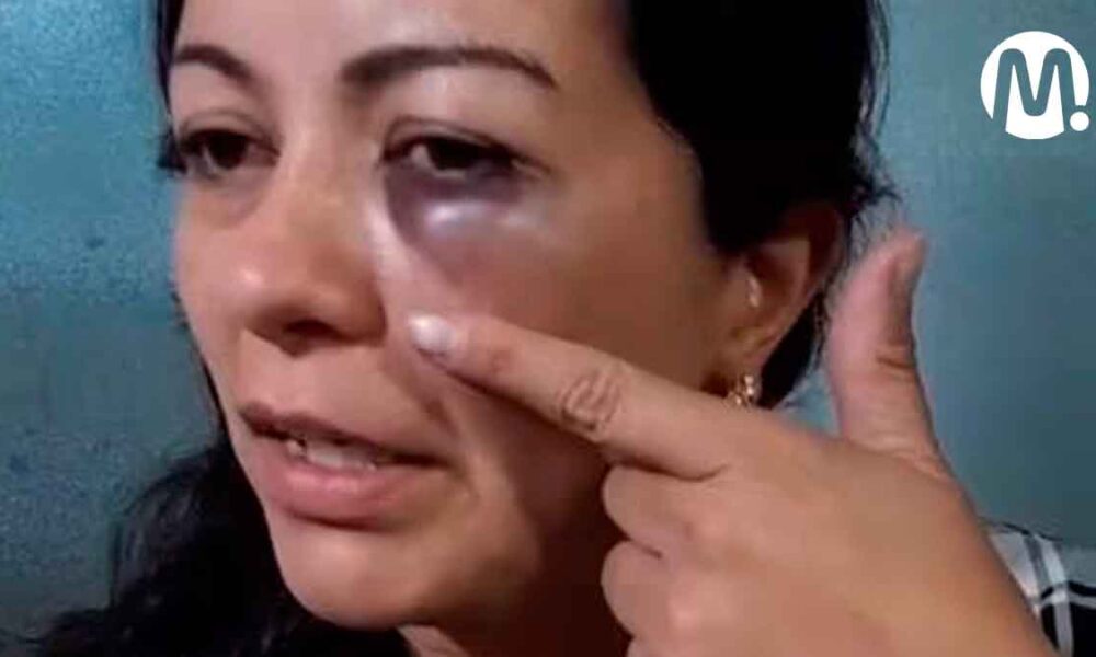 Estudiante golpeó brutalmente a profesora que le quitó el celular