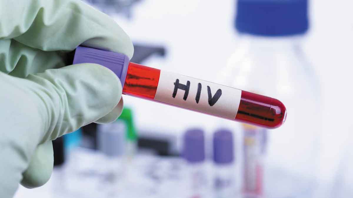Villavicencio y otros tres municipios concentran la mayoría de casos de VIH en el Meta durante 2025