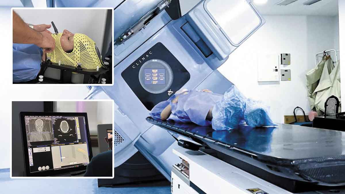 Nueva tecnología permite tratar el cáncer sin cirugías abiertas en el Hospital de Villavicencio
